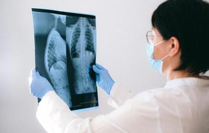 Profissional de saúde  analisa Raio X